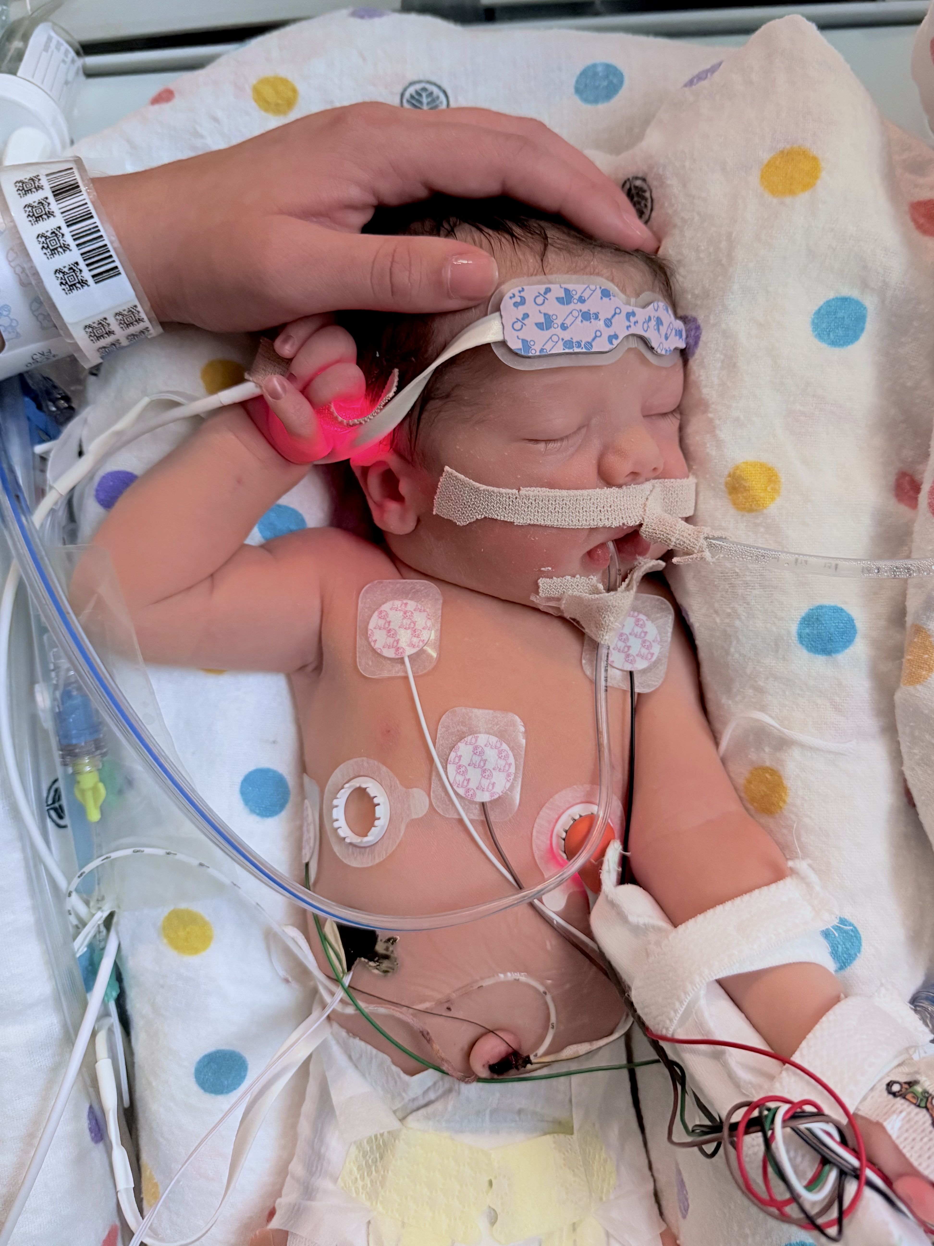Samuel resting in the NICU