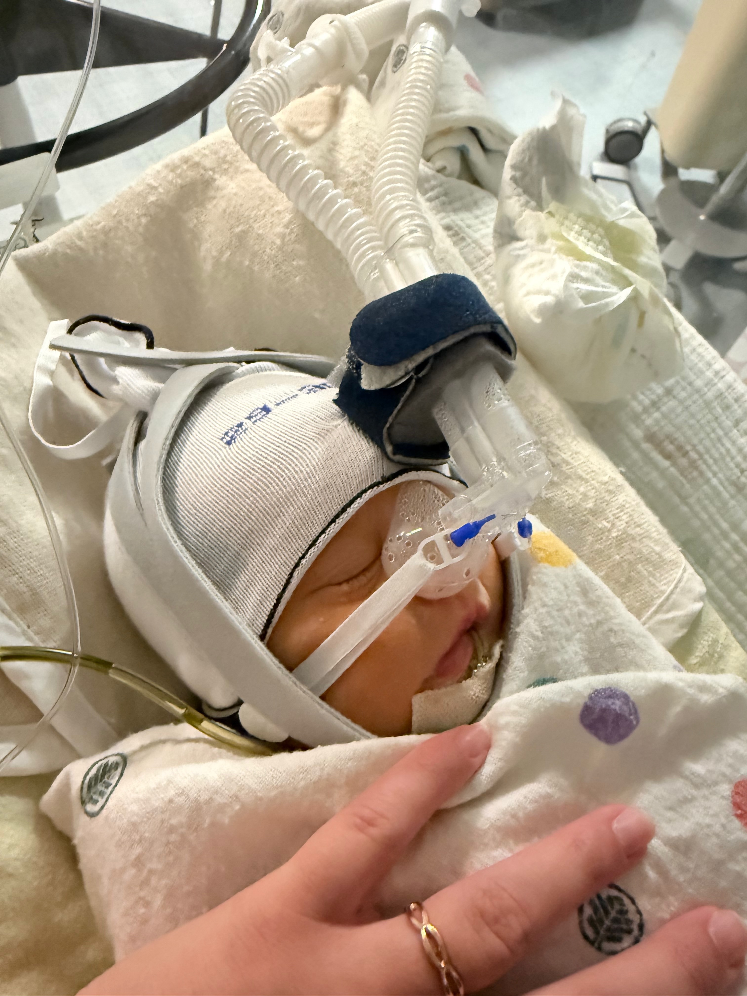 Samuel after breathing tube removed