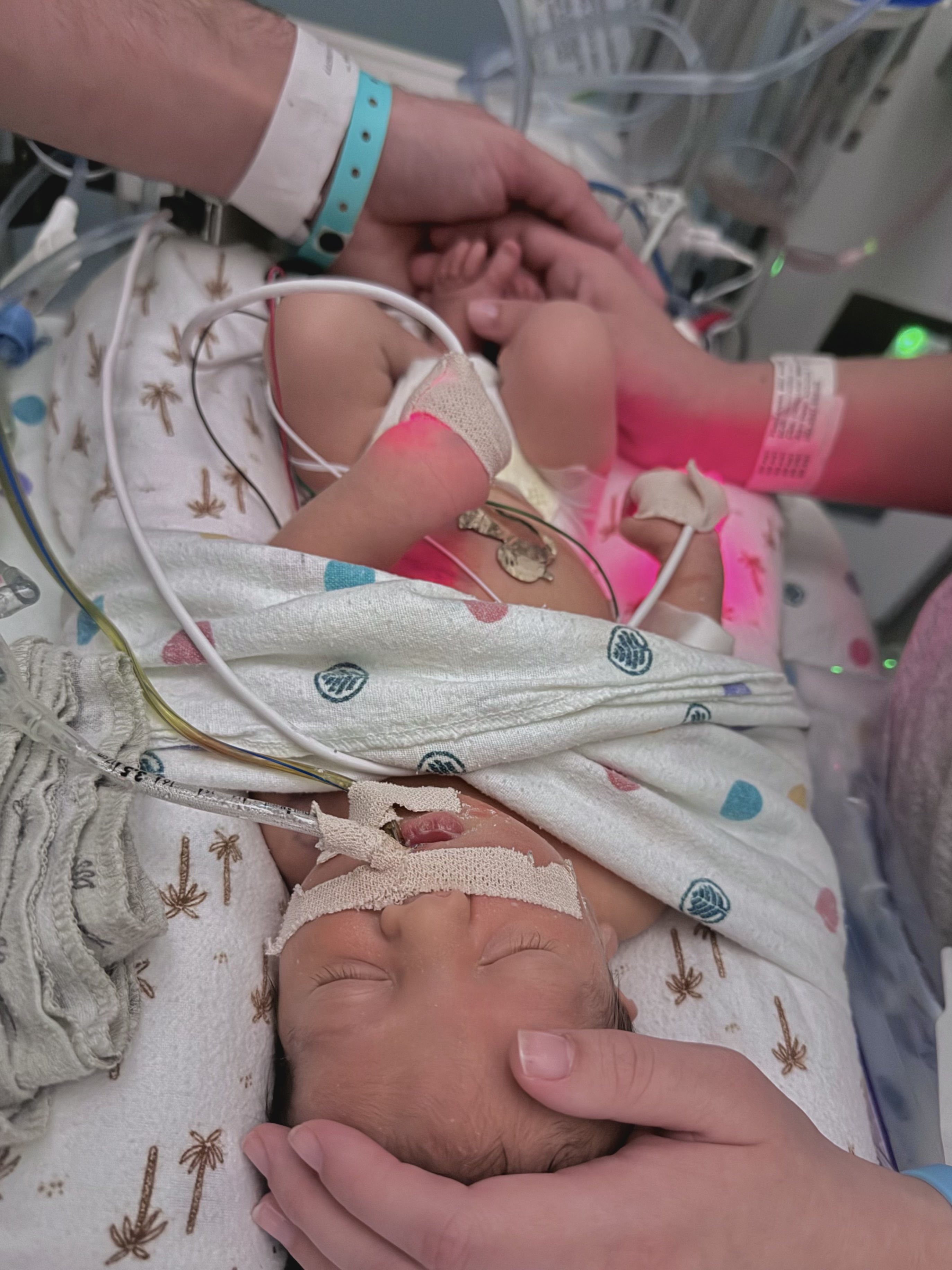 Family hands on Samuel in the NICU
