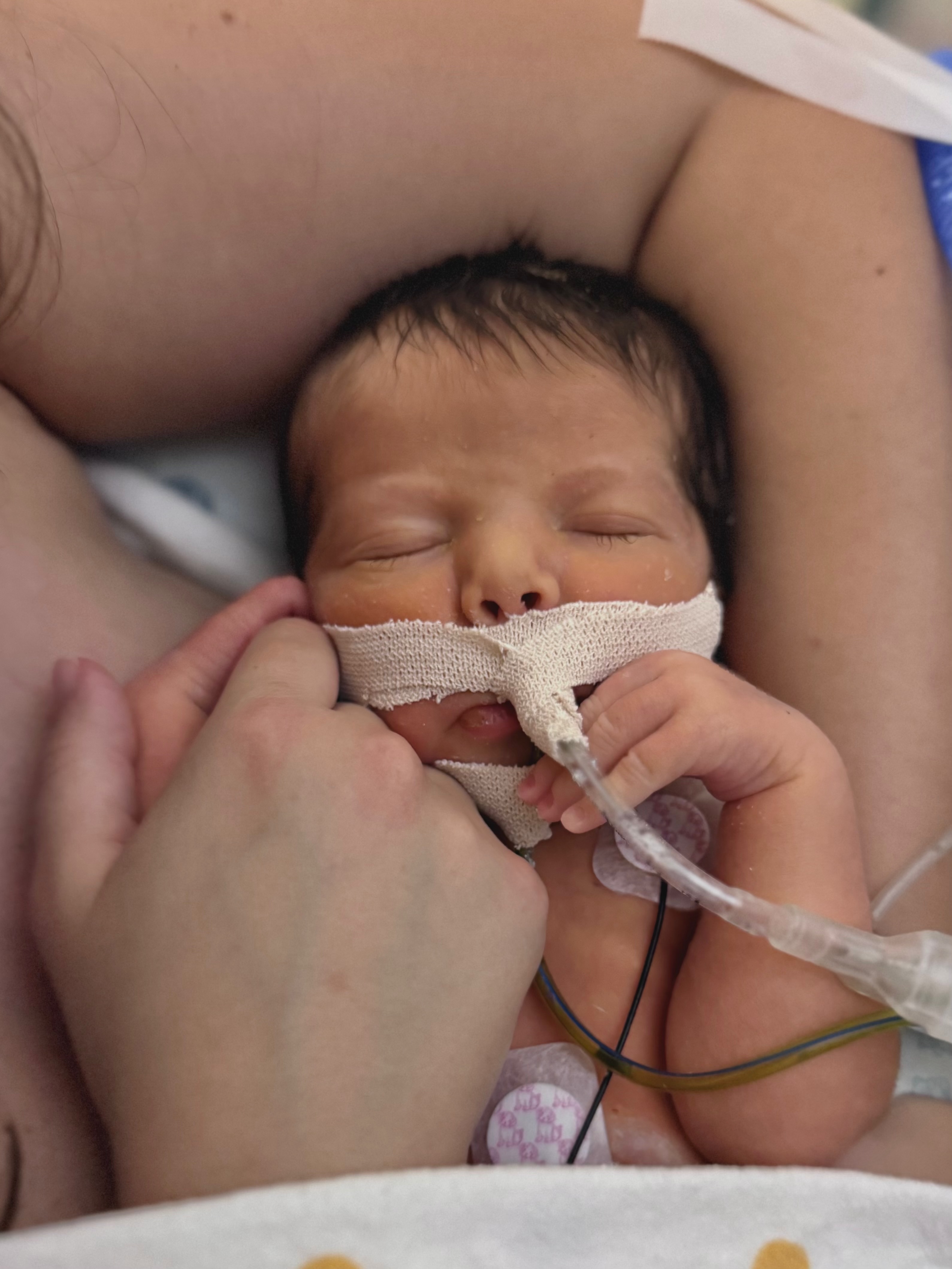 Close up of Samuel in the NICU